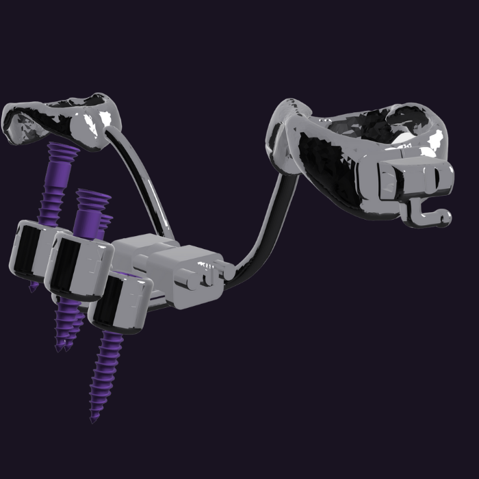 MARPE Uygulama Protokolü